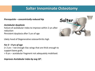 Salter Innominate Osteotomy

Prerequisite – concentrically reduced hip

Acetabular dysplasia
Failure of acetabular index to improve within 2 yrs after
reduction
Persistent dysplasia after 5 yrs of age

Likely hood of Degenerative osteoarthritis high

For 2 – 9 yrs of age
(< 2 yrs – not enough iliac wings that are thick enough to
support bone graft,
> 9 yrs – acetabular fragment not adequately mobilized.

Improves Acetabular index by avg 10°.
 