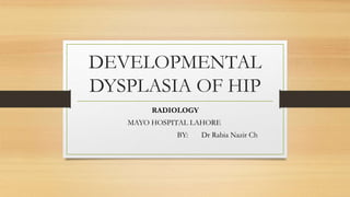 DEVELOPMENTAL
DYSPLASIA OF HIP
RADIOLOGY
MAYO HOSPITAL LAHORE
BY: Dr Rabia Nazir Ch
 