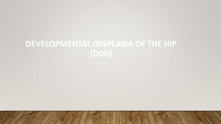 DEVELOPMENTAL DYSPLASIA OF THE HIP
(DDH)
 
