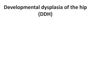 Developmental dysplasia of the hip
(DDH)
 