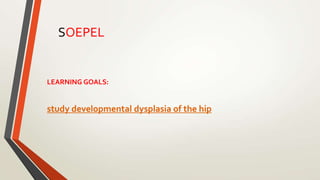 LEARNING GOALS:
study developmental dysplasia of the hip
SOEPEL
 