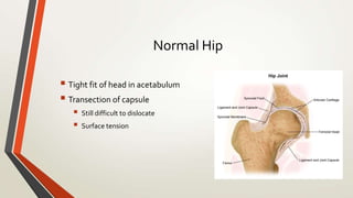 Normal Hip
 Tight fit of head in acetabulum
 Transection of capsule
 Still difficult to dislocate
 Surface tension
 