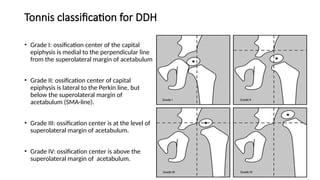ddh-presentationhsgsjsjdhdbdjdjhdgdjddkdhgdhddjjdgdhddjdh-pptx
