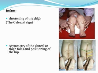 Hip dislocation | PPSX