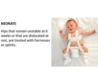 NEONATE
Hips that remain unstable at 6
weeks or that are dislocated at
rest, are treated with harnesses
or splints.
 