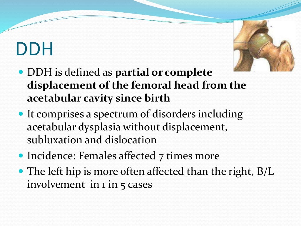 Developmental Dysplasia of Hip