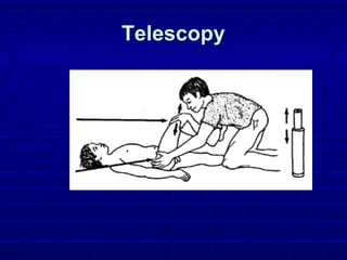 TelescopyTelescopy
 