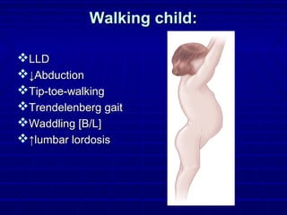Walking child:Walking child:
LLDLLD
↓↓AbductionAbduction
Tip-toe-walkingTip-toe-walking
Trendelenberg gaitTrendelenberg gait
Waddling [B/L]Waddling [B/L]
↑↑lumbar lordosislumbar lordosis
 
