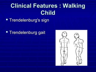 Clinical Features : WalkingClinical Features : Walking
ChildChild
 Trendelenburg's signTrendelenburg's sign
 Trendelenburg gaitTrendelenburg gait
 