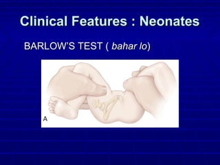 Clinical Features : NeonatesClinical Features : Neonates
BARLOW’S TEST (BARLOW’S TEST ( bahar lobahar lo))
 