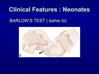 Clinical Features : NeonatesClinical Features : Neonates
BARLOW’S TEST (BARLOW’S TEST ( bahar lobahar lo))
 