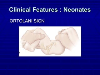 Clinical Features : NeonatesClinical Features : Neonates
ORTOLANI SIGNORTOLANI SIGN
 