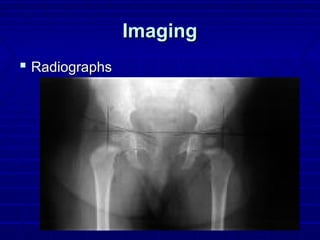 ImagingImaging
 RadiographsRadiographs
 