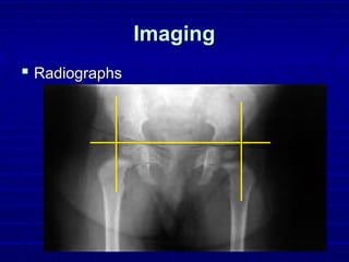 ImagingImaging
 RadiographsRadiographs
 