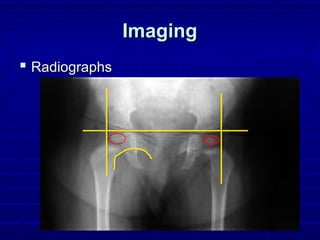 ImagingImaging
 RadiographsRadiographs
 