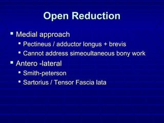Open ReductionOpen Reduction
 Medial approachMedial approach
 Pectineus / adductor longus + brevisPectineus / adductor longus + brevis
 Cannot address simeoultaneous bony workCannot address simeoultaneous bony work
 Antero -lateralAntero -lateral
 Smith-petersonSmith-peterson
 Sartorius / Tensor Fascia lataSartorius / Tensor Fascia lata
 