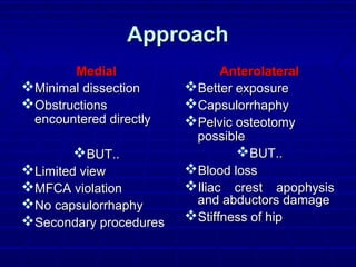 ApproachApproach
MedialMedial
Minimal dissectionMinimal dissection
ObstructionsObstructions
encountered directlyencountered directly
BUT..BUT..
Limited viewLimited view
MFCA violationMFCA violation
No capsulorrhaphyNo capsulorrhaphy
Secondary proceduresSecondary procedures
AnterolateralAnterolateral
Better exposureBetter exposure
CapsulorrhaphyCapsulorrhaphy
Pelvic osteotomyPelvic osteotomy
possiblepossible
BUT..BUT..
Blood lossBlood loss
Iliac crest apophysisIliac crest apophysis
and abductors damageand abductors damage
Stiffness of hipStiffness of hip
 