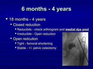6 months - 4 years6 months - 4 years
 18 months - 4 years18 months - 4 years
 Closed reductionClosed reduction
 Reducibile - check arthrogram andReducibile - check arthrogram and medial dye poolmedial dye pool
 Irreducible - Open reductionIrreducible - Open reduction
 Open redcutionOpen redcution
 Tight - femoral shorteningTight - femoral shortening
 Stable - +/- pelvic osteotomyStable - +/- pelvic osteotomy
 