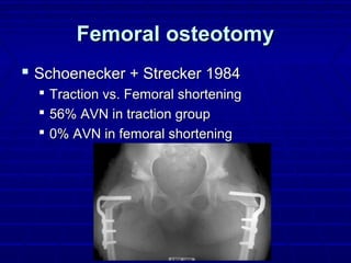 Femoral osteotomyFemoral osteotomy
 Schoenecker + Strecker 1984Schoenecker + Strecker 1984
 Traction vs. Femoral shorteningTraction vs. Femoral shortening
 56% AVN in traction group56% AVN in traction group
 0% AVN in femoral shortening0% AVN in femoral shortening
 