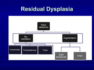 Residual DysplasiaResidual Dysplasia
 