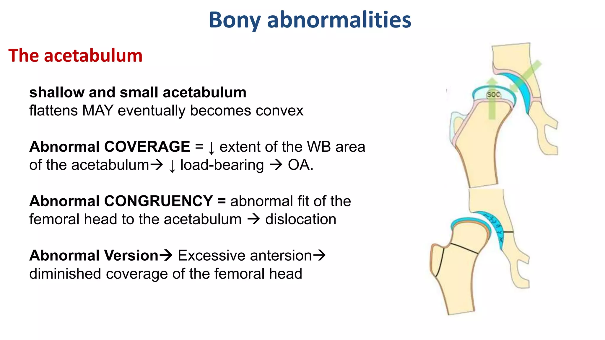 shallow and small acetabulum
flattens MAY eventually becomes convex
Abnormal COVERAGE = ↓ extent of the WB area
of the acetabulum ↓ load-bearing  OA.
Abnormal CONGRUENCY = abnormal fit of the
femoral head to the acetabulum  dislocation
Abnormal Version Excessive antersion
diminished coverage of the femoral head
The acetabulum
Bony abnormalities
 