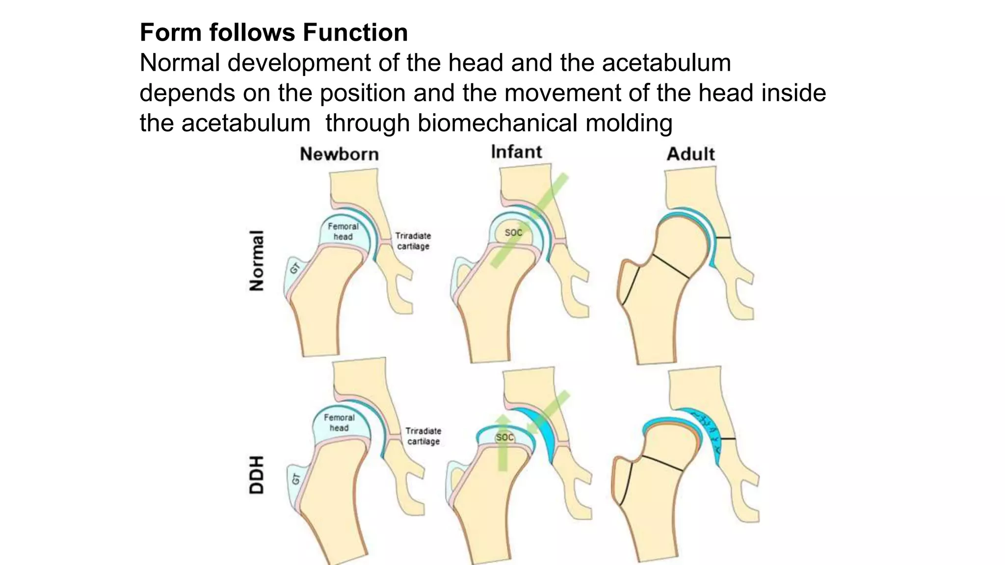 Form follows Function
Normal development of the head and the acetabulum
depends on the position and the movement of the head inside
the acetabulum through biomechanical molding
 
