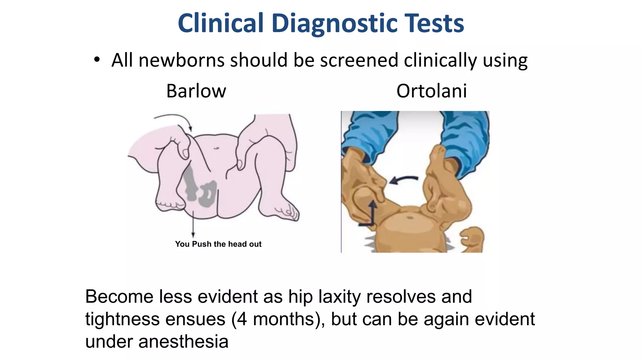Clinical Diagnostic Tests
• All newborns should be screened clinically using
Barlow Ortolani
Become less evident as hip laxity resolves and
tightness ensues (4 months), but can be again evident
under anesthesia
You Push the head out
 