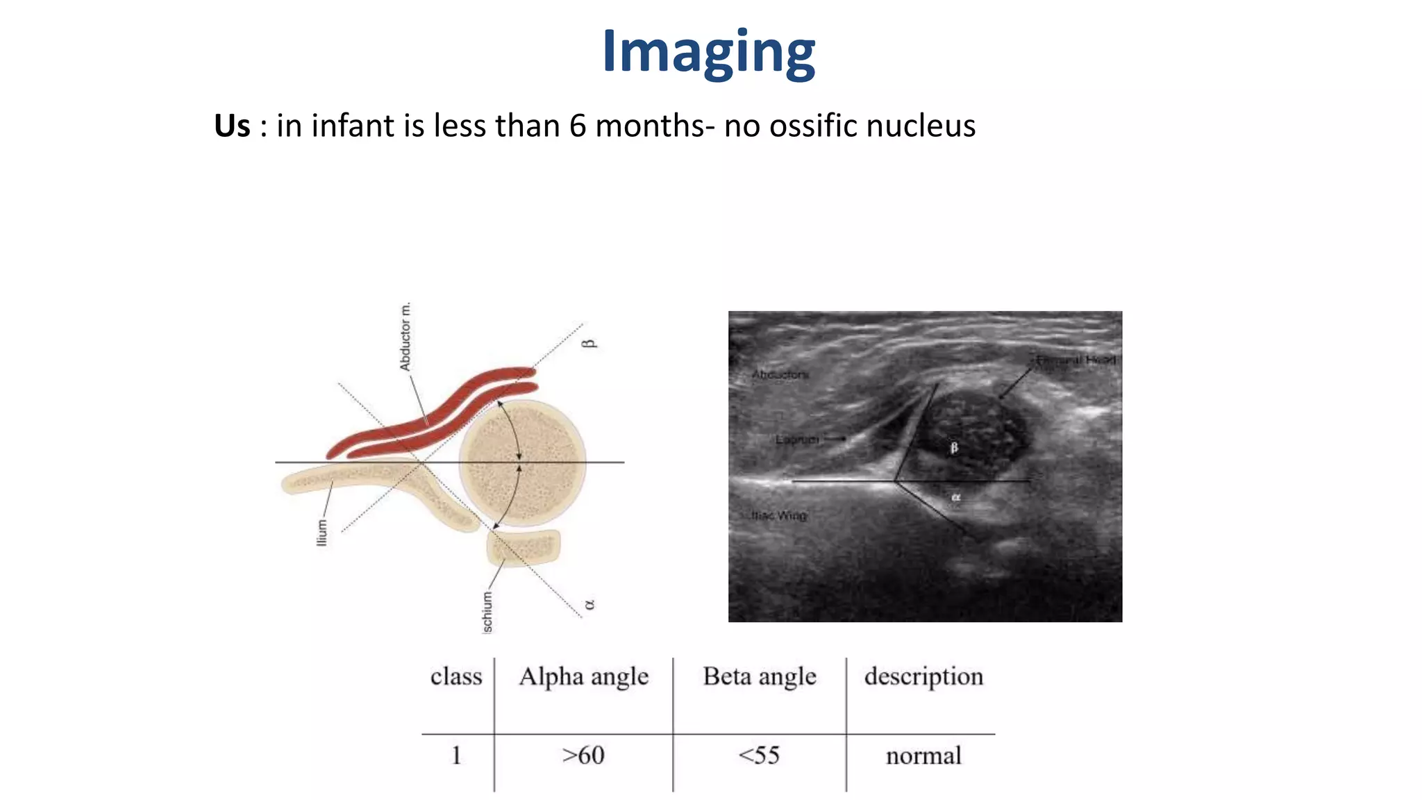 Imaging
Us : in infant is less than 6 months- no ossific nucleus
 