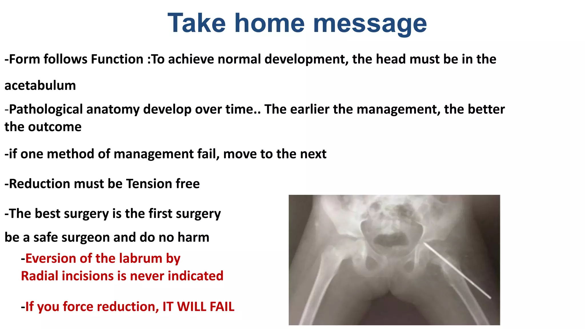 -Form follows Function :To achieve normal development, the head must be in the
acetabulum
-Pathological anatomy develop over time.. The earlier the management, the better
the outcome
-if one method of management fail, move to the next
-Reduction must be Tension free
-The best surgery is the first surgery
be a safe surgeon and do no harm
-Eversion of the labrum by
Radial incisions is never indicated
-If you force reduction, IT WILL FAIL
Take home message
 