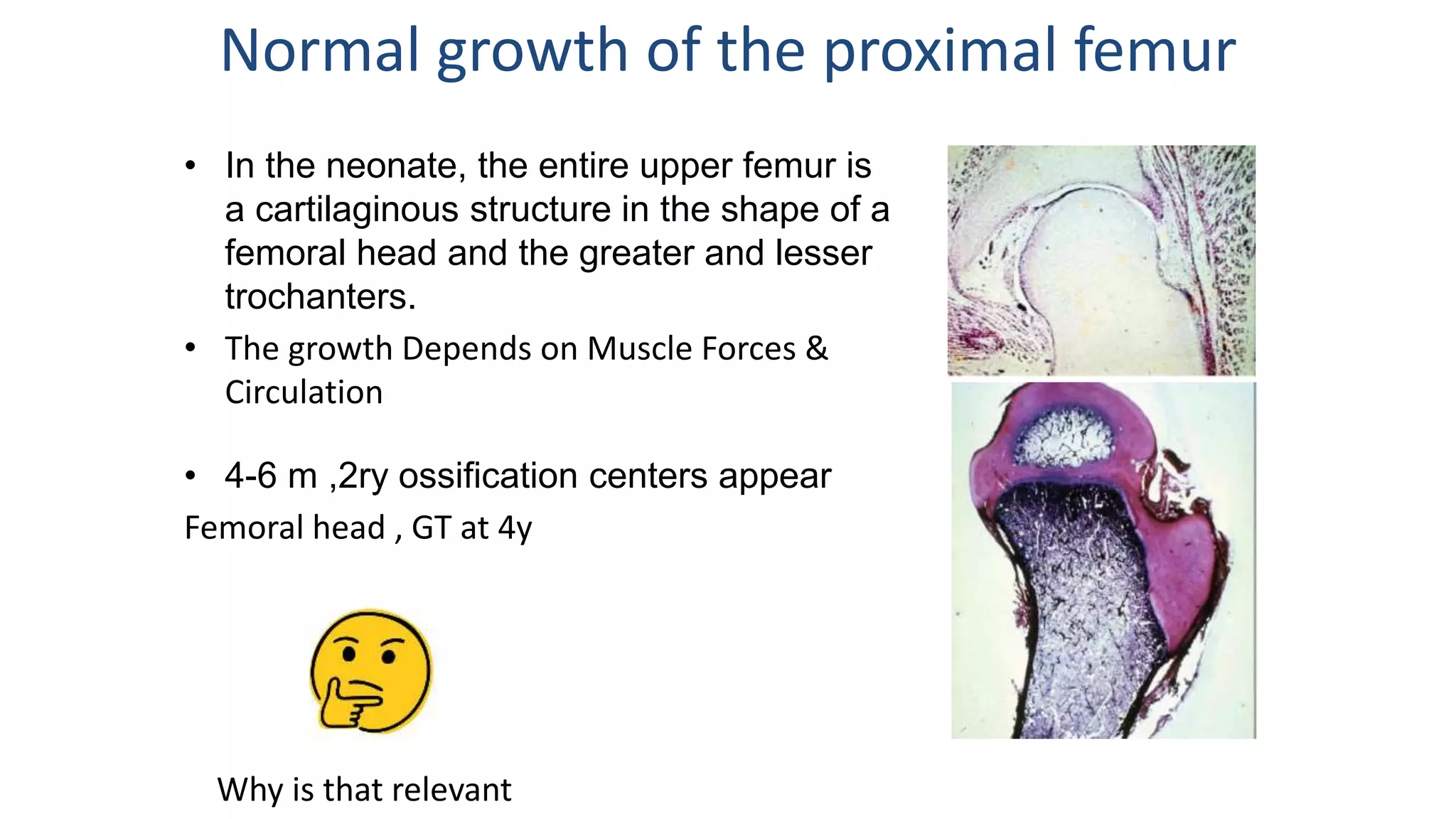 Normal growth of the proximal femur
• In the neonate, the entire upper femur is
a cartilaginous structure in the shape of a
femoral head and the greater and lesser
trochanters.
• The growth Depends on Muscle Forces &
Circulation
• 4-6 m ,2ry ossification centers appear
Femoral head , GT at 4y
Why is that relevant
 