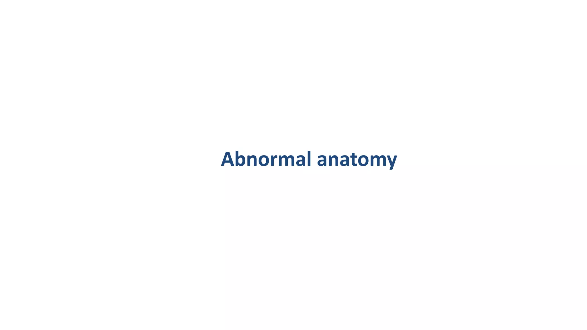 Abnormal anatomy
 