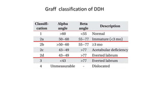 DDH introduction and algorithm.pptx