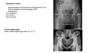 DDH introduction and algorithm.pptx