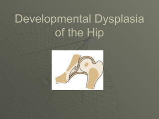 Developmental Dysplasia
       of the Hip
 