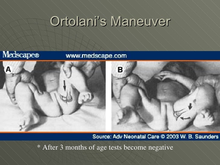 Developmental Dysplasia of the Hip and Ultrasound