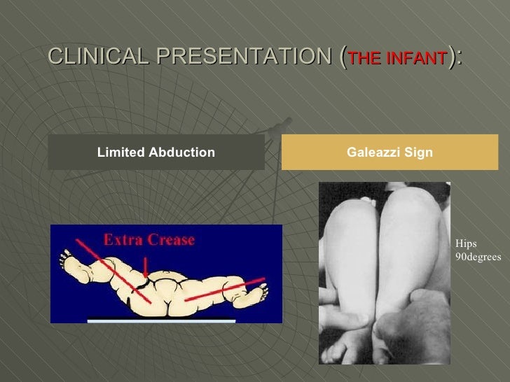 denver developmental screening test denver developmental screening test