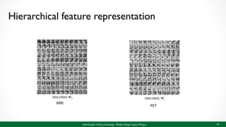 Hierarchical feature representation
Introdução à Deep Learning - Walter Hugo Lopez Pinaya 66
MRI
PET
 