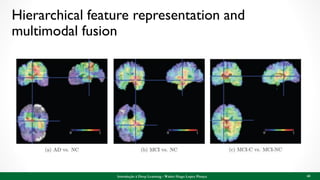 Hierarchical feature representation and
multimodal fusion
Introdução à Deep Learning - Walter Hugo Lopez Pinaya 68
 