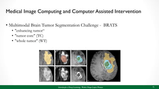Medical Image Computing and Computer Assisted Intervention
• Multimodal Brain Tumor Segmentation Challenge - BRATS
• "enhancing tumor“
• "tumor core" (TC)
• "whole tumor" (WT)
Introdução à Deep Learning - Walter Hugo Lopez Pinaya 71
 