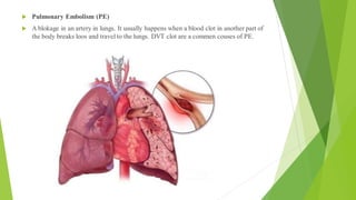  Pulmonary Embolism (PE)
 A blokage in an artery in lungs. It usually happens when a blood clot in another part of
the body breaks loos and travel to the lungs. DVT clot are a commen couses of PE.
 