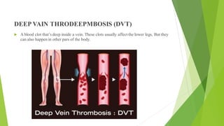 DEEP VAIN THRODEEPMBOSIS (DVT)
 A blood clot that’s deep inside a vein. These clots usually affect the lower legs, But they
can also happen in other pars of the body.
 