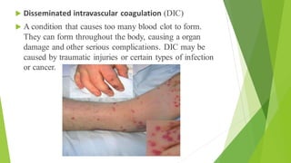  Disseminated intravascular coagulation (DIC)
 A condition that causes too many blood clot to form.
They can form throughout the body, causing a organ
damage and other serious complications. DIC may be
caused by traumatic injuries or certain types of infection
or cancer.
 