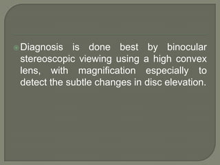 Diagnosis is done best by binocular
stereoscopic viewing using a high convex
lens, with magnification especially to
detect the subtle changes in disc elevation.
 