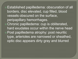 Established papilledema: obscuration of all
borders, disc elevated, cup filled, blood
vessels obscured on the surface,
peripapillary hemorrhages.
Chronic papilledema: cup is obliterated,
hard exudates occur within the nerve head
Post papilledema atrophy: post neuritic
type, arterioles are narrowed or sheathed,
optic disc appears dirty gray and blurred
 