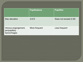 Papilledema Papillitis
Disc elevation 2-6 D Does not exceed 2-3D
Venous engorgement,
peripapillary
hemorrhages
More frequent Less frequent
 