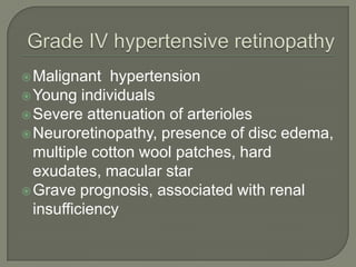 Malignant hypertension
Young individuals
Severe attenuation of arterioles
Neuroretinopathy, presence of disc edema,
multiple cotton wool patches, hard
exudates, macular star
Grave prognosis, associated with renal
insufficiency
 