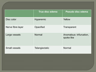 True disc edema Pseudo disc edema
Disc color Hyperemic Yellow
Nerve fibre layer Opacified Transparent
Large vessels Normal Anomalous- trifurcation,
spoke like
Small vessels Telangiectatic Normal
 