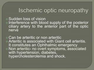  Sudden loss of vision
 Interference with blood supply of the posterior
ciliary artery to the anterior part of the optic
nerve
 Can be arteritic or non arteritic
 Arteritic is associated with Giant cell arteritis.
It constitutes an Ophthalmic emergency
 Non arteritic- no overt symptoms, associated
with hypertension, diabetes,
hypercholesterolemia and shock.
 
