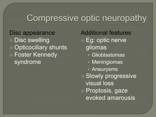 Disc appearance
 Disc swelling
 Opticociliary shunts
 Foster Kennedy
syndrome
Additional features
 Eg: optic nerve
gliomas
• Glioblastomas
• Meningiomas
• Aneurysms
 Slowly progressive
visual loss
 Proptosis, gaze
evoked amarousis
 
