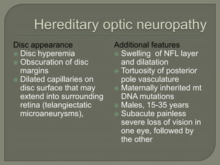 Disc appearance
 Disc hyperemia
 Obscuration of disc
margins
 Dilated capillaries on
disc surface that may
extend into surrounding
retina (telangiectatic
microaneurysms),
Additional features
 Swelling of NFL layer
and dilatation
 Tortuosity of posterior
pole vasculature
 Maternally inherited mt
DNA mutations
 Males, 15-35 years
 Subacute painless
severe loss of vision in
one eye, followed by
the other
 